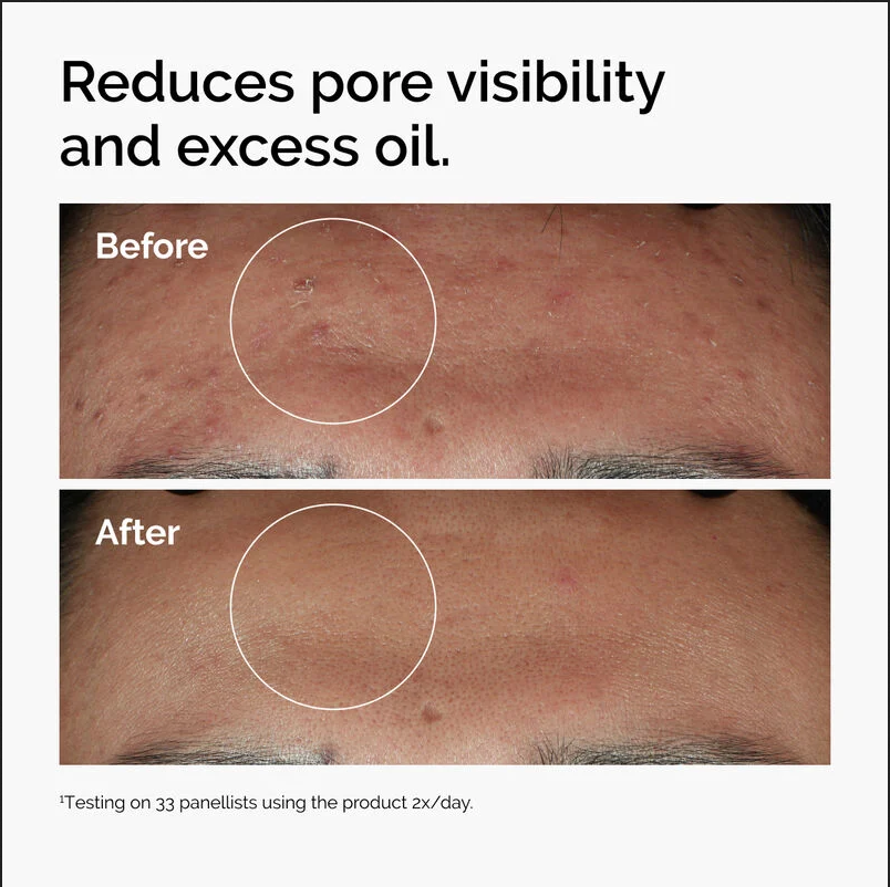 The Ordinary Niacinamide 10% + Zinc 1% (60 ml)